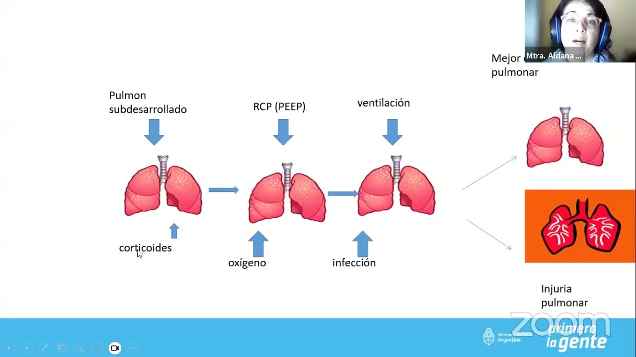 Cuidado de Enfermería al Neonato con CPAP