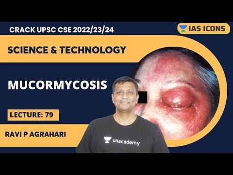 Science & Technology | L79 Mucormycosis | UPSC CSE 2023 | Ravi P Agrahari