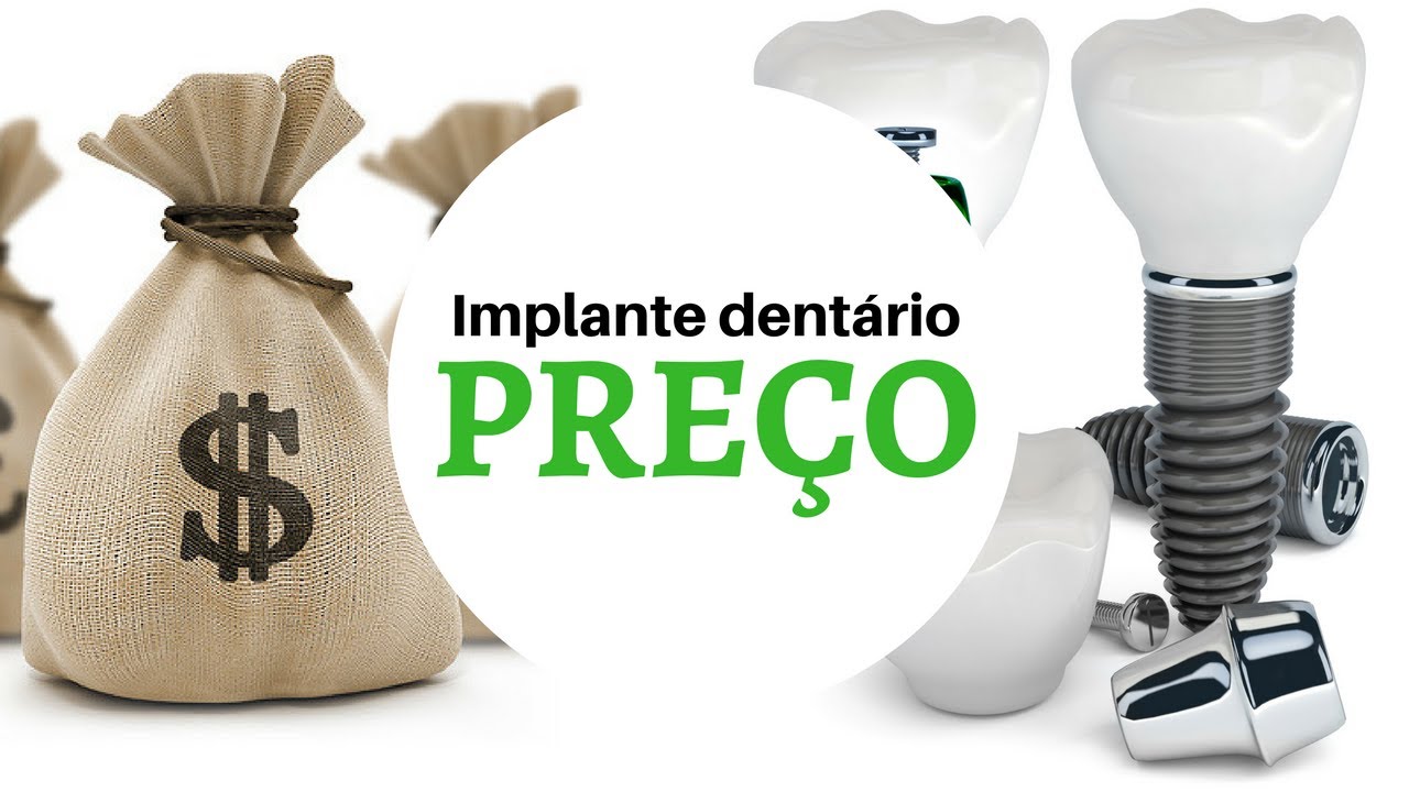 tipos de implantes dentarios e preços