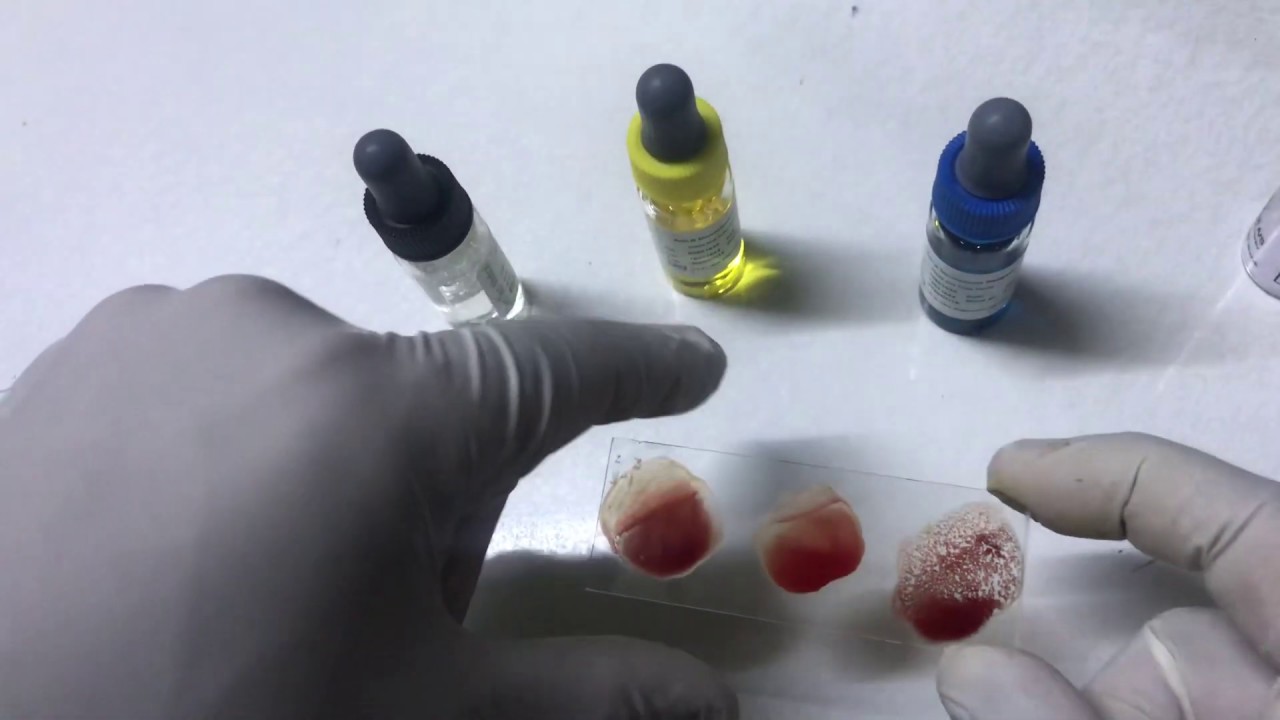 كيف  تتعرف على فصيله الدم بكل سهوله بشكل عملي واضح Blood group estimation .. blood grouping