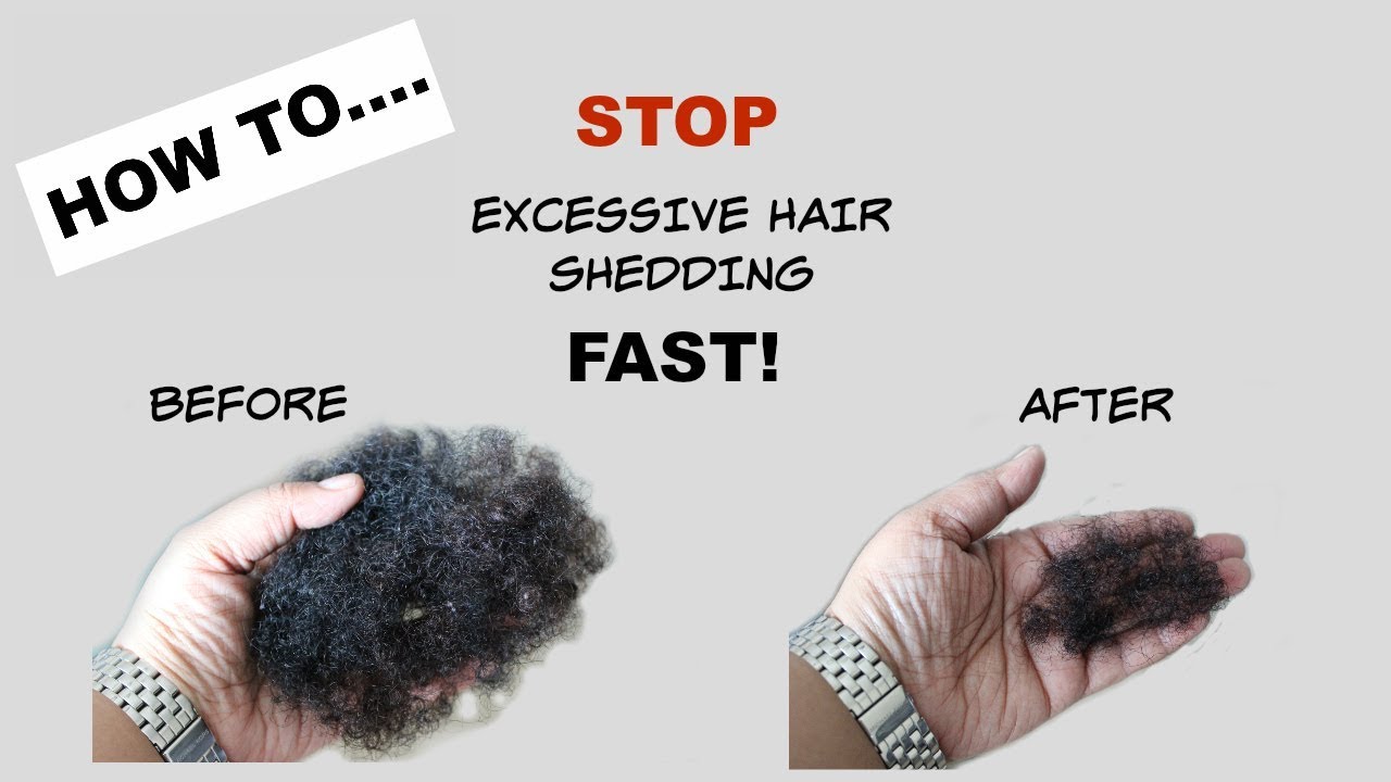 STOP Excessive Hair Shedding Fast Tea Rinse Natural Hair YouTube