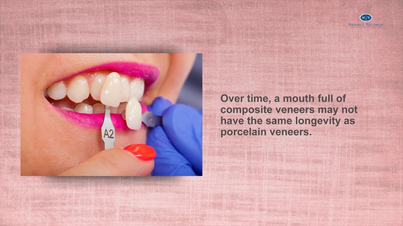 The Convenience of Veneers from your New York City Cosmetic Dentist