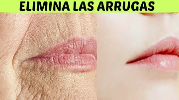 ¿Cómo puedo eliminar rápidamente las arrugas de la cara?