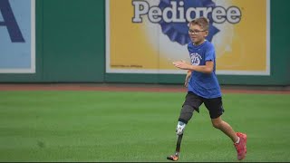 9-year-old gets surprise of a lifetime after undergoing amputation