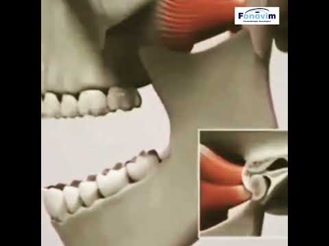 Vídeo: A articulação temporomandibular causa refluxo ácido?