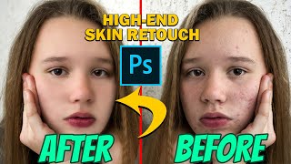 High-End Skin Retouching & Remove Blemishes in Photoshop Tutorial