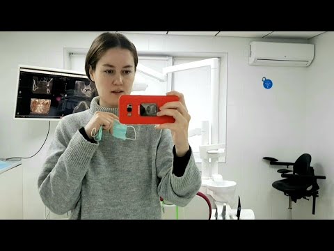 Зубной имплант. Моя история 💫 Это больно? Как долго? Дорого?