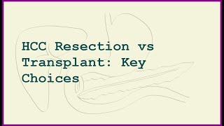 HCC Surgery: Resection vs Liver Transplant