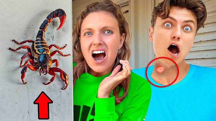 Scorpion STUNG My Brother Carter Sharer! *hospital visit*