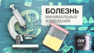 видео: Болезнь минимальных изменений. Нефротический синдром. картинка: Болезнь минимальных изменений. Нефротический синдром.