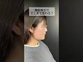 【小顔整形】脂肪吸引でどこまで変わる?#shorts
