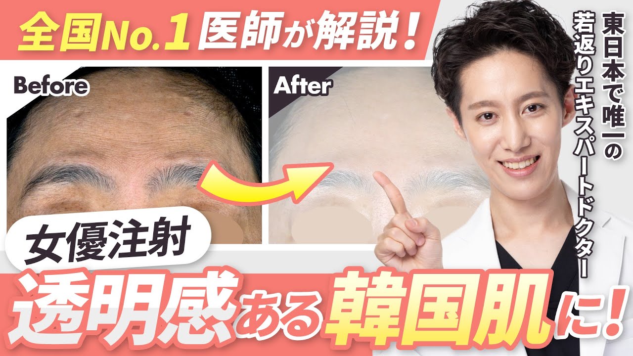 【大感激】これであなたも女優肌！専門医が