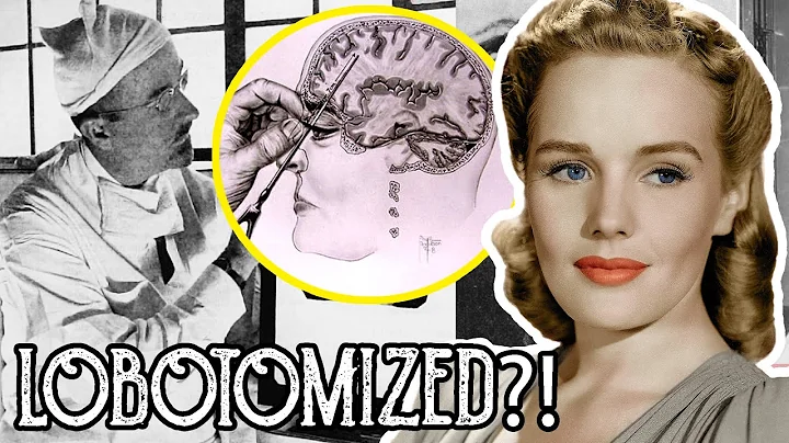 Why Frances Farmers Lobotomy Is One of the Saddest...