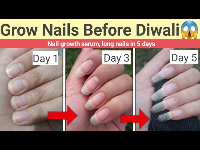 Grow Long Nails In 5 days | Nail Growth Serum for long and healthy nails |  Glow Yourself💅 - YouTube