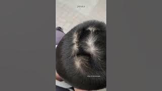 Unyeng-unyeng Lebih dari 2 tandanya apa?