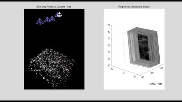 6-DOF Probe Tracking via Skin Mapping for Freehand 3D Ultrasound