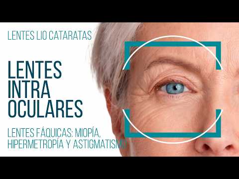 Lentes de cataratas y lentes de miopía. Diferencias
