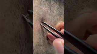 #waxing #ingrownhair #trending #maazsafder #hairremoval #asmr #hair #beard #remove #natural NK.094.