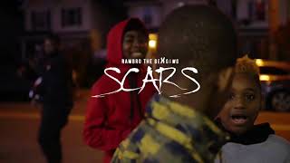 RamBro The Bexgawd | Scars