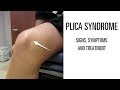 Plica syndrome: Signs, symptoms and treatment of this uncomfortable knee pain