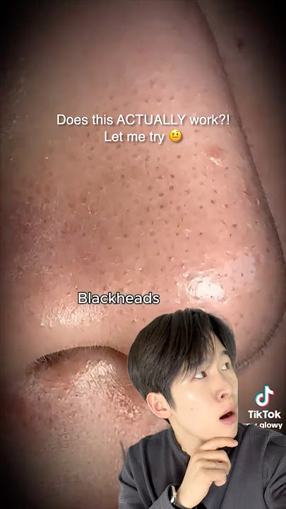 Does Oil Pulling REALLY work?! 🤨