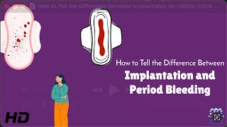 Implantation Cramps vs Period Pain – Clear Signs!