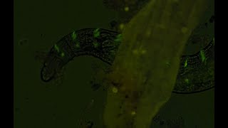GLOWING Microscopic Potworm Hairs!! FIRST LOOK!! Update