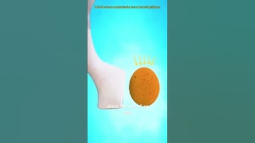 Gastric Bypass Surgery (3D Animation) #drone #theflash #space #automobile #scifi #lyrics #music