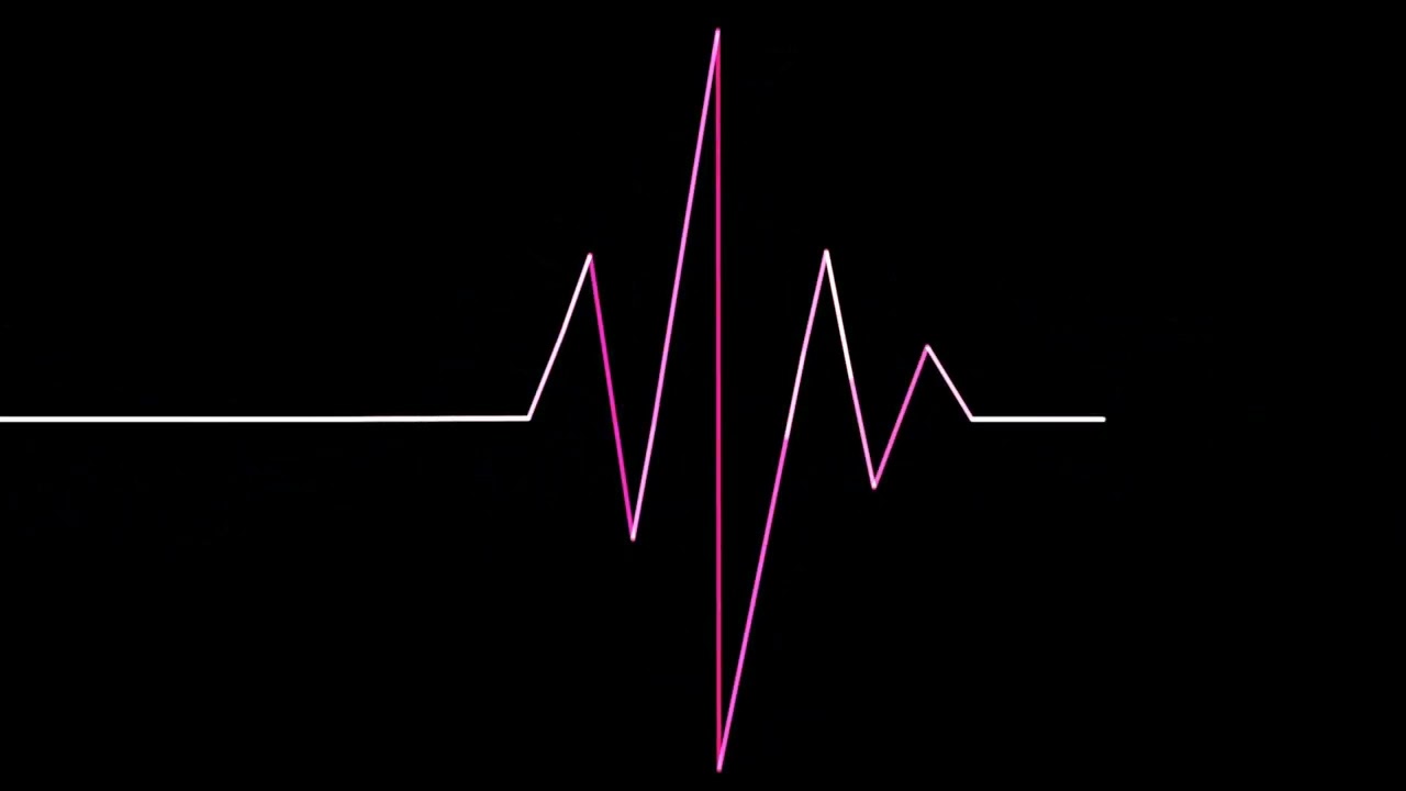 NEON ATTACK | Electro Bass, Deep Bass House