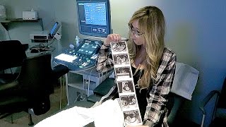 NUCHAL TRANSLUCENCY ULTRASOUND TEST AT 12 WEEKS! NUCHAL TRANSLUCENCY ULTRASOUND TEST AT 12 WEEKS!