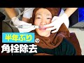 【角栓】半年ぶりに病院治療で鼻の黒ずみ取りに行ったら大量にとれた【いちご鼻撃退】【角質角栓除去】