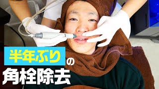 【角栓】半年ぶりに病院治療で鼻の黒ずみ取りに行ったら大量にとれた【いちご鼻撃退】【角質角栓除去】