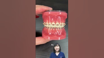 Show diễn niềng răng nè anh em ơi | Dr Anh Thư