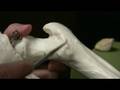 Bones  ligaments of the knee femur tibia  pelvis
