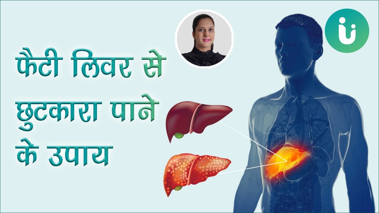 फैटी लिवर में क्या खाएं क्या ना खाएं और घरेलू उपाय Fatty liver diet