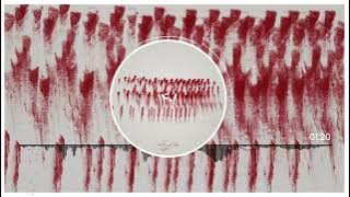 Leito, Sijal, Khalse - 1401 - آهنگ اعتراضی جدید لیتو و سیجل و خلسه به نام 1401