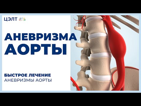 Видео: Аорта - лечение на аортата с народни средства и методи