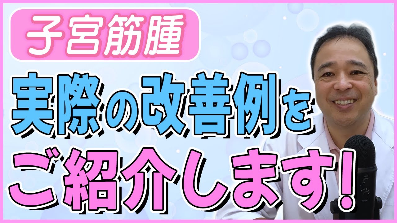 【子宮筋腫】聞けば役立つかも!?実際の症例のお話【専門家】