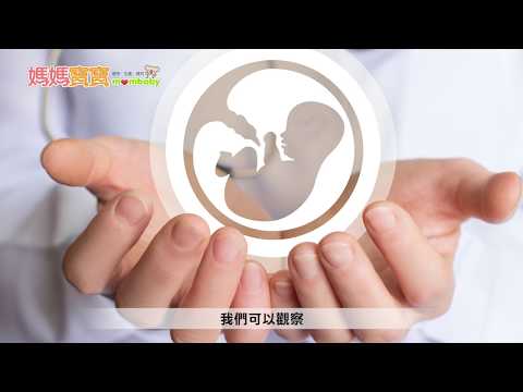 懷孕Q&A．未足月破水｜媽媽寶寶MOM TV