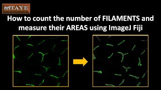 How to count the number of FILAMENTS and measure their AREAS using ImageJ Fiji