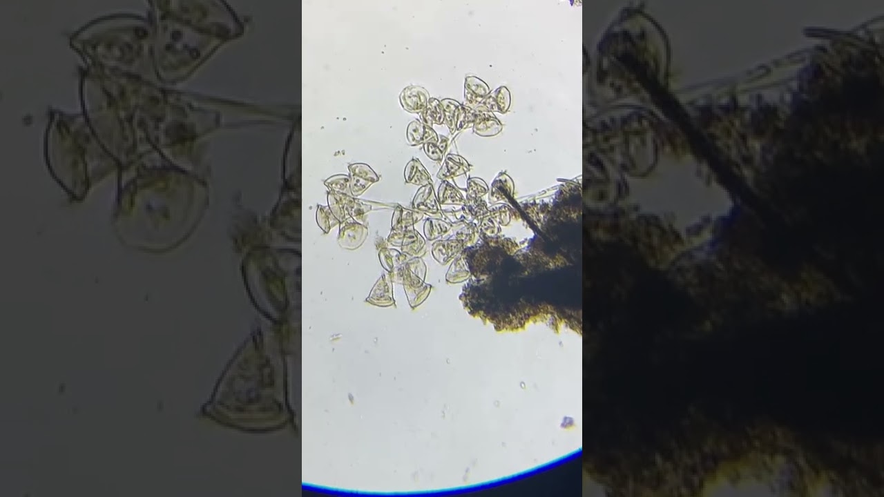 Vorticella under a microscope 