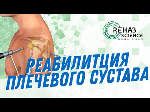 Реабилитация после операции на плечо. Операция по Банкарту.