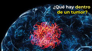 ¿Puede reducirse un tumor con antibióticos?