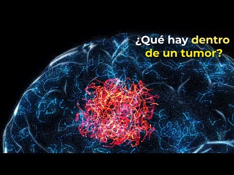 Vídeo: Se Ha Descubierto El Mecanismo De Autodestrucción De Los Tumores Cancerosos - Vista Alternativa