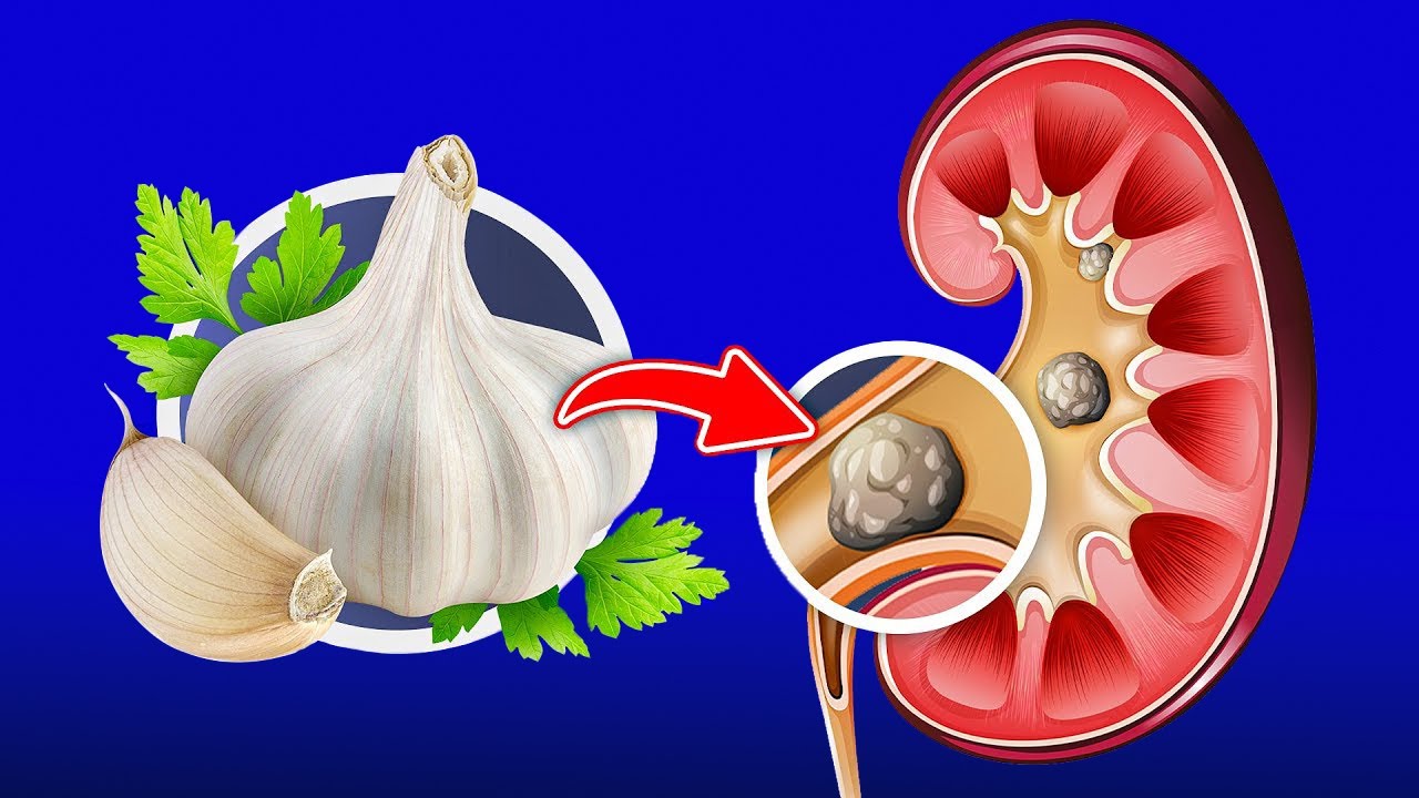 Top 10 Foods To Detox Your Kidneys - YouTube
