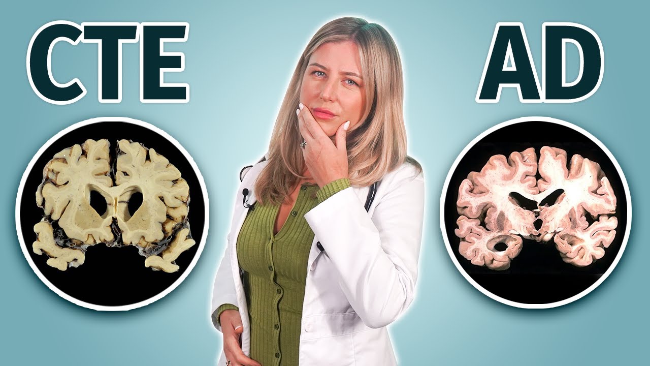 ALZHEIMER'S VS CTE 