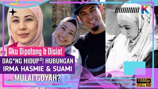 Aku Dipotong & Disiat Dag*ng Hidup²! Hubungan Irma Hasmie & Suami Mulai Goyah?