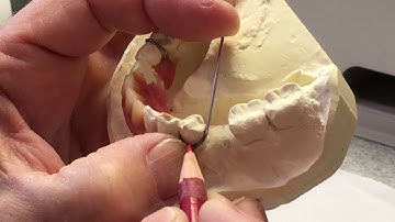 Wire bending a clasp