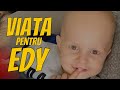 ❤️MrOciu85 Fapte Bune - Viata pentru Edy Apel umanitar