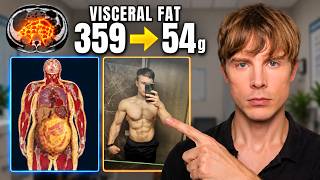How I Lost 85% of My Visceral Fat - Advanced Strategies